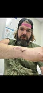 Man injured by psycho woman