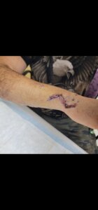 Man injured by psycho woman